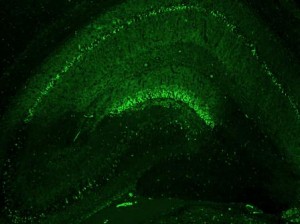 Degenerating neurons in a section of mouse hippocampus stained with PathoGreen Histofluorescent Stain.