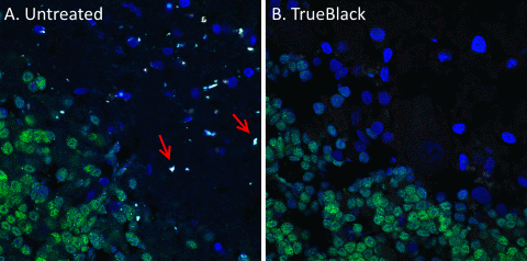 Quenching of lipofuscin autofluorescence using TrueBlack pretreatment. Formaldehyde-fixed human cortex cryosections were left untreated (A) or treated with TrueBlack (B), then stained with CF488A anti-NeuN antibody conjugate (green) and DAPI (blue). Sections were imaged in all channels on a Zeiss LSM700 confocal microscope. Lipofuscin fluoresces brightly in all channels, appearing as white spots in the merged image of untreated tissue (A). TrueBlack pretreatment eliminated lipofuscin autofluorescence (B), with negligible effect on specific staining.