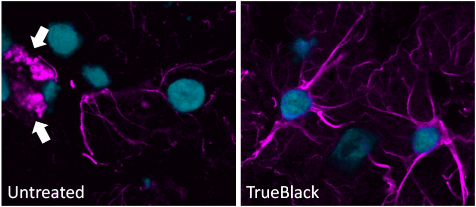 Trueblack CF640R GAR DAPI ihc composite