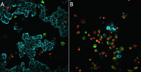 MitoView Blue, NucView 530, CF488A Annexin MCF7 composite