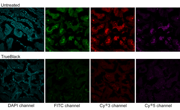 reduces autofluorescence in human kidney sections in the fitc