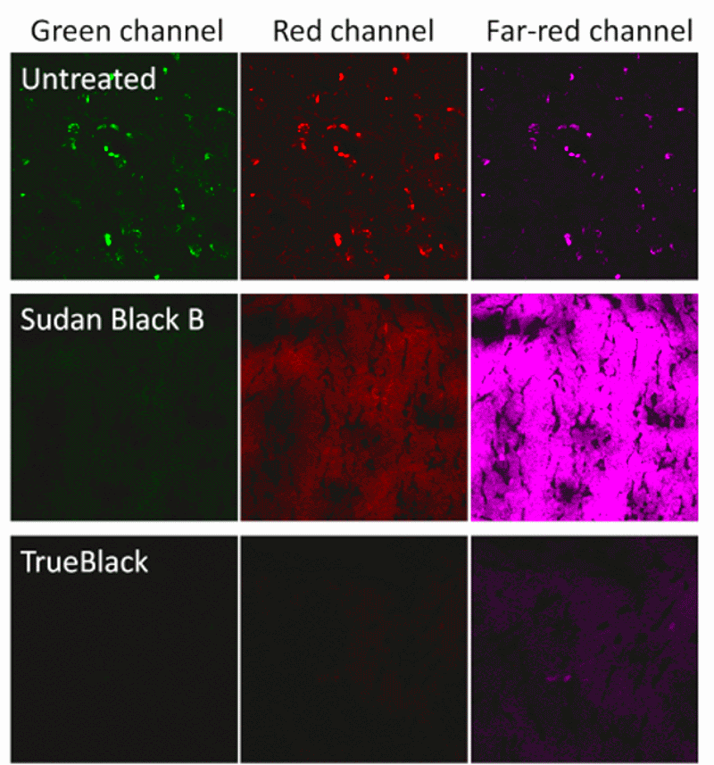 Figure 1. Lipofuscin autofluorescence in methanol-fixed adult human brain (cerebral cortex) tissue sections. In untreated tissue (top row), lipofuscin appeared as fluorescent granules that fluoresced in all fluorescence channels. Sudan Black B (middle row) masked lipofuscin autofluorescence, but introduced background in the red and far-red channels. 