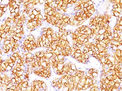 Monoclonal anti Proximal Nephrogenic Antigen / Renal Cell Carcinoma (RCC) (PN 15)