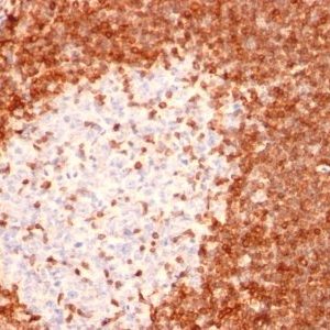 Monoclonal anti bcl 2 (8C8)