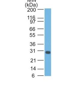 Monoclonal anti bcl x (BX006)