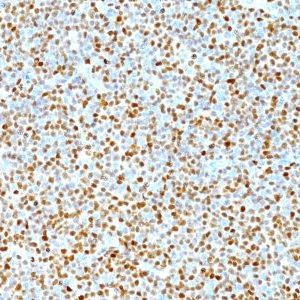 Monoclonal anti Cyclin D1 (DCS 6)