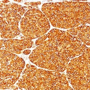 Monoclonal anti Tyrosinase (T311)