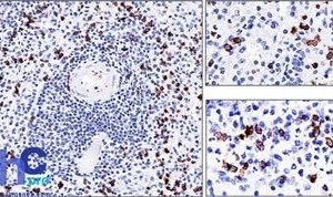 Monoclonal anti CD57 / B3GAT1 (NK 1)