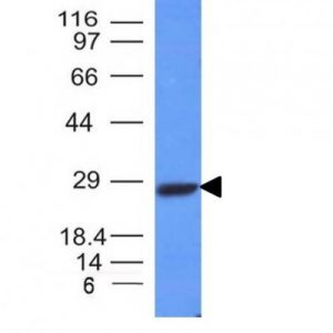 Monoclonal anti Kappa Light Chain (L1C1)