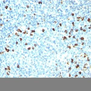 Monoclonal anti Lambda Light Chain (ICO 106)