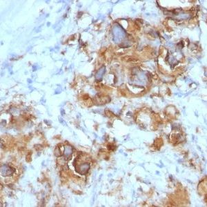 Monoclonal anti CA19 9 (Sialyl Lewis A) (121SLE)