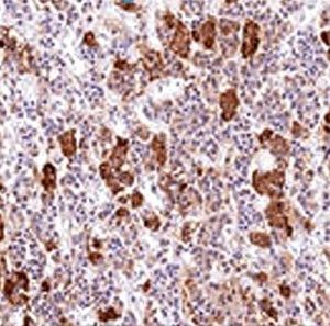 Monoclonal anti ACTH (Adrenocorticotrophic Hormone) (AH26)