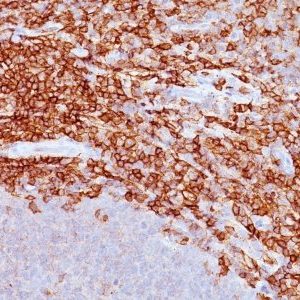 Monoclonal anti CD43 (DF T1)