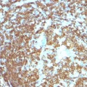 Monoclonal anti CD45RA (158 4D3)