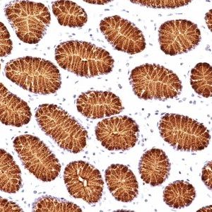 Monoclonal anti Mucin 5AC (MUC5AC) (45M1)