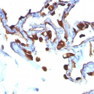 Monoclonal anti Cytokeratin 8/18 (C 51)