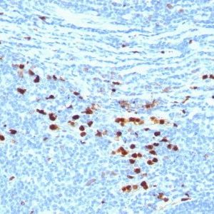 Monoclonal anti Calgranulin B / MRP 8/ 14 / MAC 387 / S100A8/A9 / Macrophage Ag (MAC387)