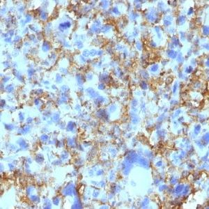 Monoclonal anti HLA DRB (LN 3)