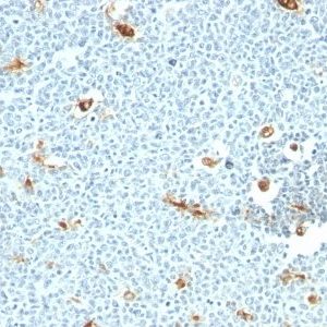 Monoclonal anti Macrophage Specific Antigen (LN 5)