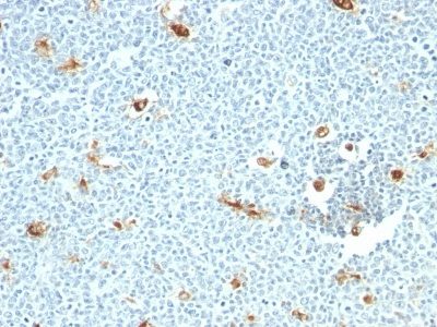 Monoclonal anti Macrophage Specific Antigen (LN 5)