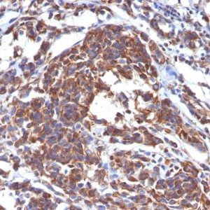 Monoclonal anti Vimentin (LN 6)