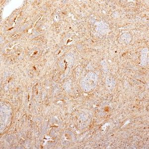 Monoclonal anti Fibronectin (2755 8)