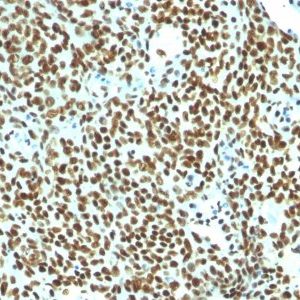 Monoclonal anti Human Nuclear Antigen (NM106)