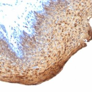 Monoclonal anti Lung Specific Antigen (LSA120)