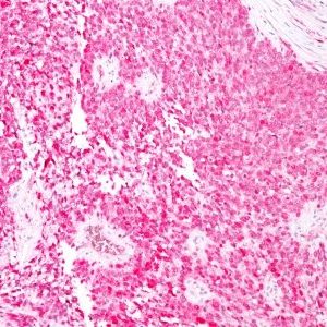 Monoclonal anti S100 (4C4.9)