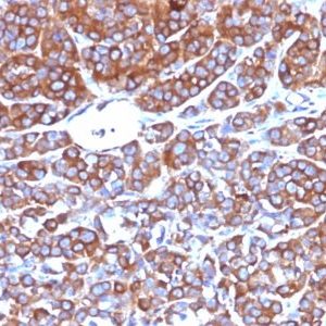 Monoclonal anti CD10 (CB CALLA)
