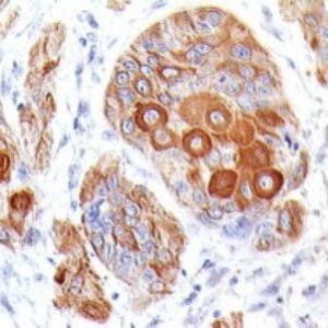 Monoclonal anti CD28 (204.12)