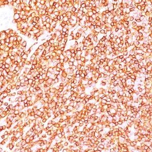 Monoclonal anti CD45RB (BRA 11G)