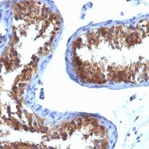 Monoclonal anti Major Vault Protein (MVP) (1032)