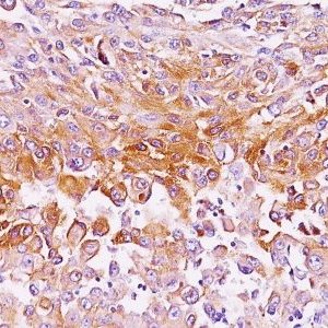 Monoclonal anti Pmel17 / gp100 / SILV (NKI beteb)