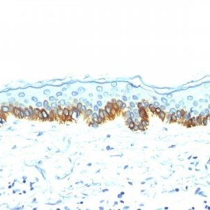 Monoclonal anti Cytokeratin, LMW (AE 1)