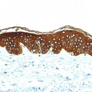 Monoclonal anti Cytokeratin, HMW (AE 3)