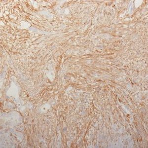 Monoclonal anti Fibronectin (HFN7.1)