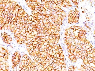 Monoclonal anti Proximal Nephrogenic Antigen / Renal Cell Carcinoma (RCC) (66.4.C2)