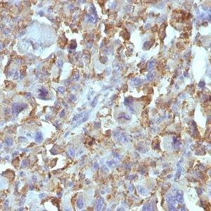 Monoclonal anti Small Cell Lung Cancer (SCLC) (MOC 52)