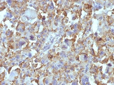 Monoclonal anti Small Cell Lung Cancer (SCLC) (MOC 52)