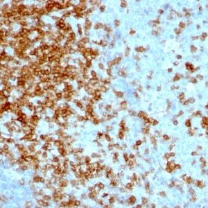 Monoclonal anti CD43 (84 3C1)