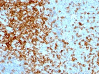 Monoclonal anti CD43 (84 3C1)