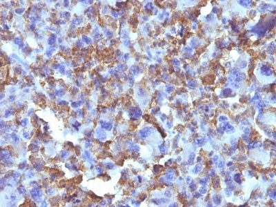 Monoclonal anti Histiocytoma Marker (D11)