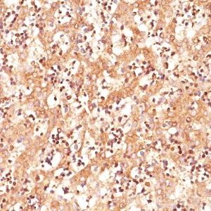 Monoclonal anti AFP (Alpha Fetoprotein) (C3)