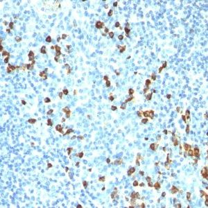 Monoclonal anti IgM Immunoglobulin (ICO 30)