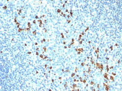 Human IgM Immunoglobulin Monoclonal Mouse Antibody (ICO-30) - Biotium