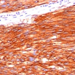 Monoclonal anti CD117 (C117/370)