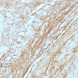 Monoclonal anti Tenascin (T2H5)