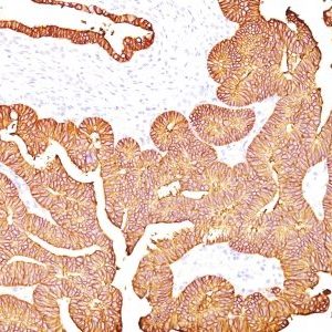 Monoclonal anti Ep CAM / CD326 (323/A3)