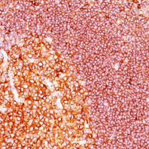 Monoclonal anti MALT 1 (MT1/410)